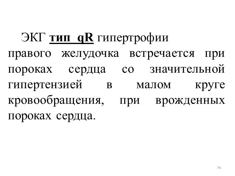 79 ЭКГ тип qR 79 ЭКГ тип qR